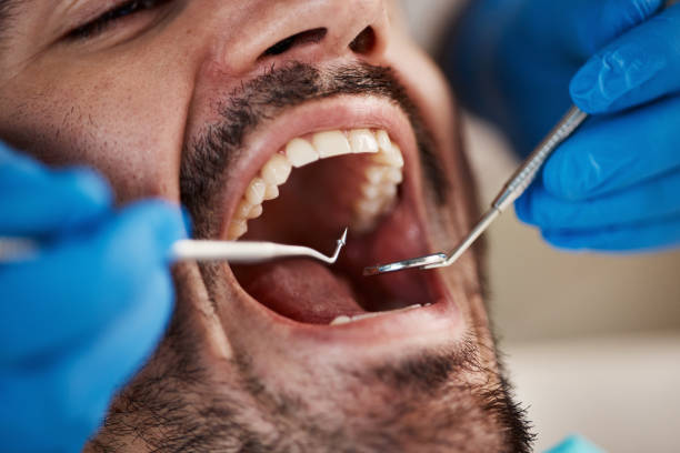 Emergency Dental Services in Montgomery, TX